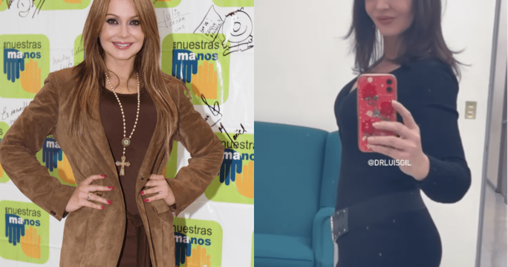 This is what Gaby Spanic looks like after plastic surgery |  News from Mexico