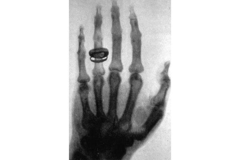 X-ray radiograph taken by Wilhelm Röntgen in 1896
